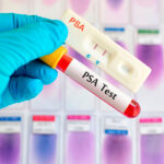 psa test