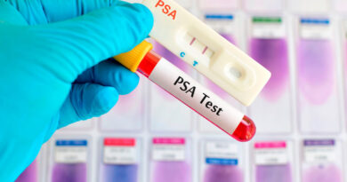 Día Mundial del Cáncer de Próstata: el análisis de sangre que permite detectar a tiempo el tumor más frecuente en hombres