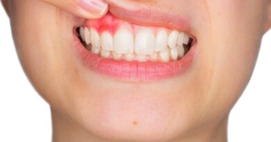 Periodontitis: la enfermedad silenciosa que provoca sangrado de encías y puede terminar con la pérdida de dientes Periodontitis: la enfermedad silenciosa que provoca sangrado de encías y puede terminar con la pérdida de dientes